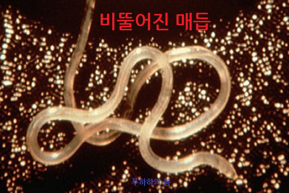 비뚤어진 매듭 [개정판]